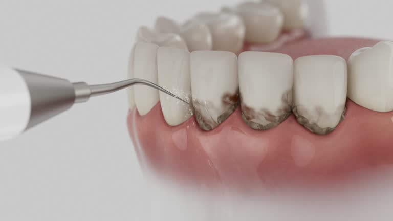 Reliable Invisalign Clear Aligners contractor in Maricopa, CA by Smile Center Dentistry